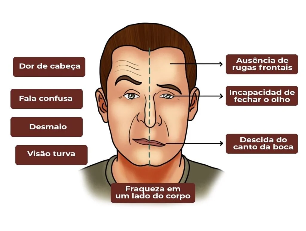 AVC Acidente Vascular Cerebral: Um Inimigo Silencioso que Você Pode ...